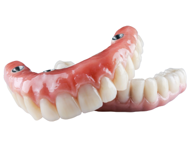 foto prótesis dental